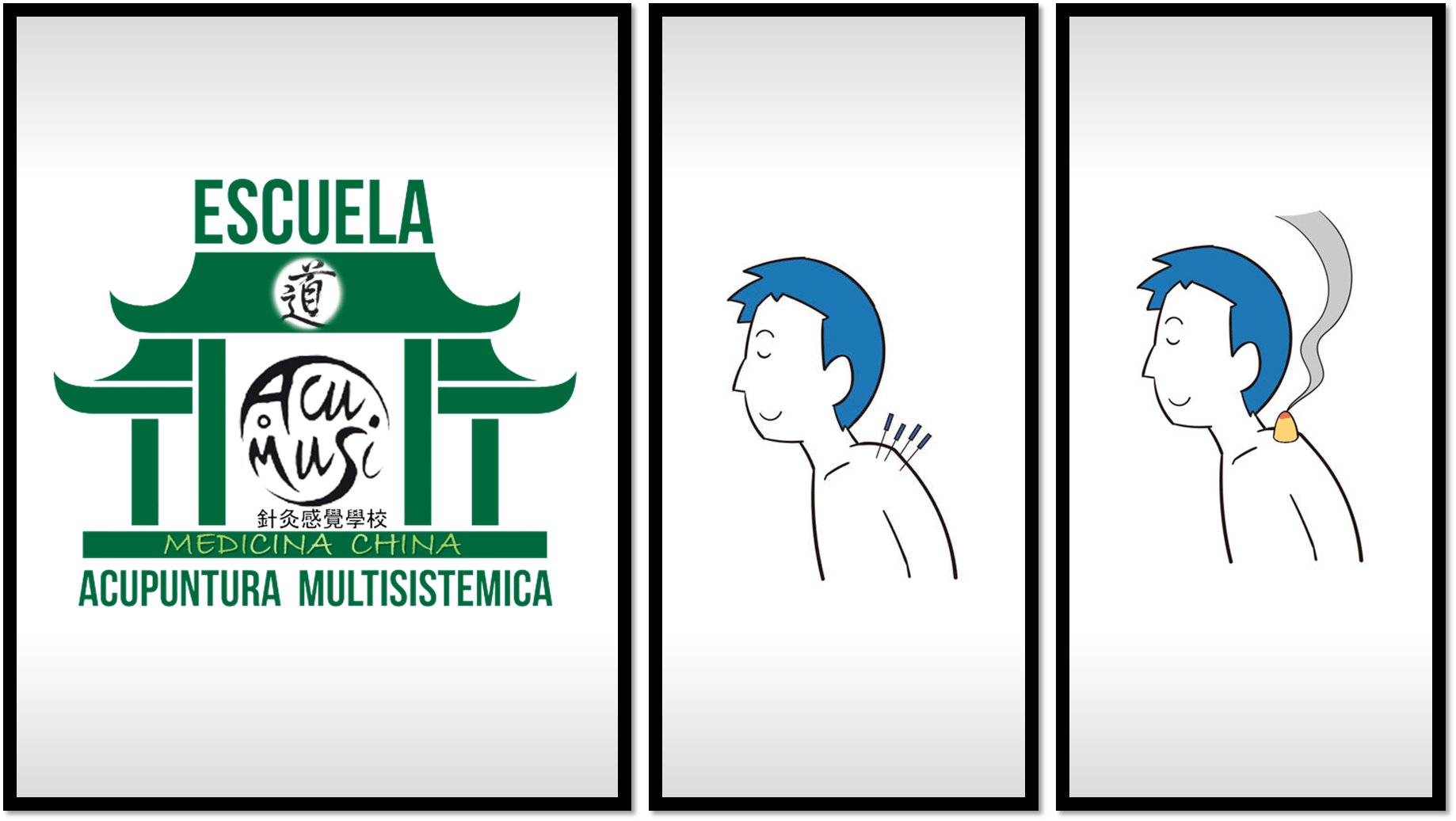 Cuadros Escuela Acupuntura Multisistémica