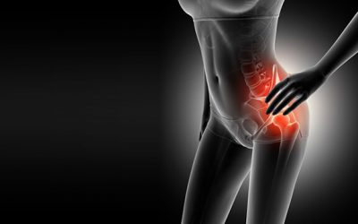 Caso Clínico: Dolor en la Articulación Coxo Femoral