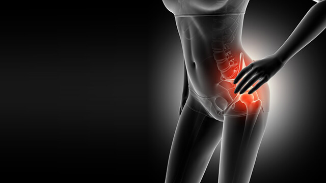 Caso Clínico: Dolor en la Articulación Coxo Femoral