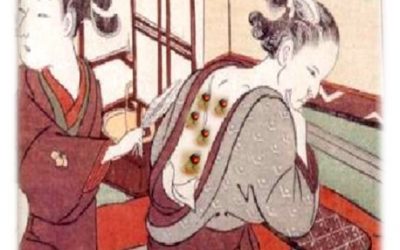 INTRODUCCIÓN A LA MOXIBUSTIÓN JAPONESA お灸 O Kyu