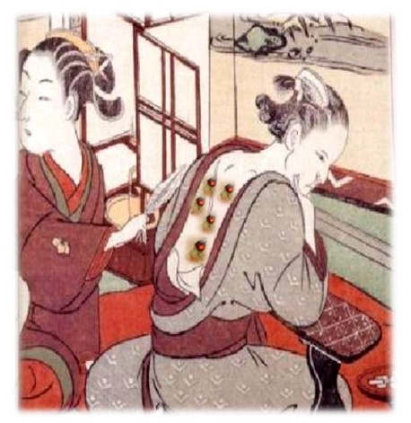 INTRODUCCIÓN A LA MOXIBUSTIÓN JAPONESA お灸 O Kyu