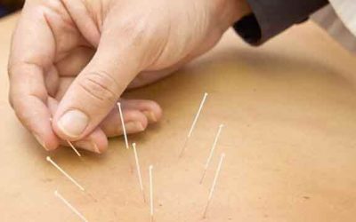 La Acupuntura en Reumatología