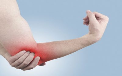 Caso Clínico: Dolor en Codo y Brazo