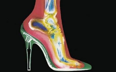 Riesgos de los Tacones (1 de 2)