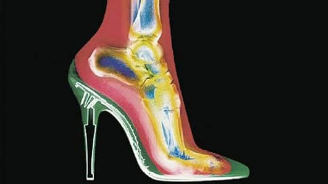 Riesgos de los Tacones (1 de 2)